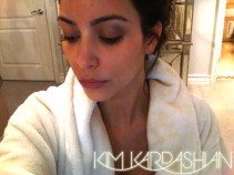 Celebrity Twitpics: Kim Kardashian Gets Black Eye
