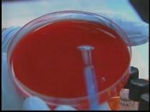Fifth Swine Flu-Related Death Reported 