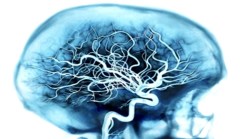 New Perspective to Increased Alzheimer's Funding