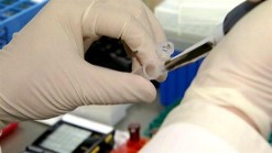 Treating Heart Attacks With Stem Cells