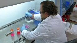 San Diegans Hope to Take Part in Parkinson's Study