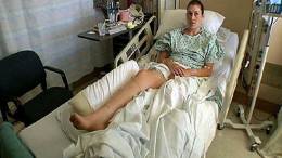 Snake Victim: Pain Worse Than Childbirth