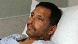 Escondido Crash Victim Talks About Recovery