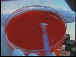 Fifth Swine Flu-Related Death Reported 