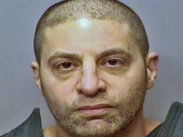 benTEST Jury Selection Begins in 'Nose Doc' Trial