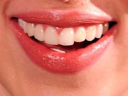 Snap On a New Smile  
