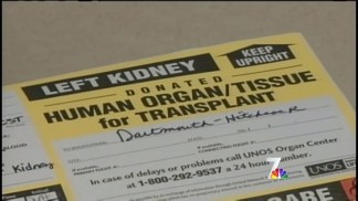 New Rules Proposed for Kidney Transplants
