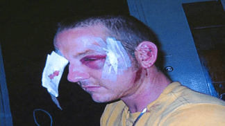 Shoplifter Claims He Was Beaten by Store Security Guard