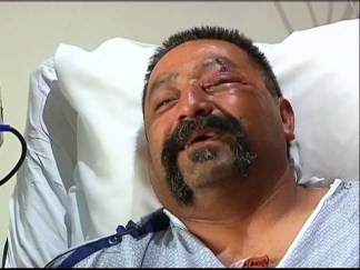 Explosion Victim Speaks About Blast