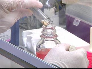 Million $ Match Made to Fight Alzheimer's