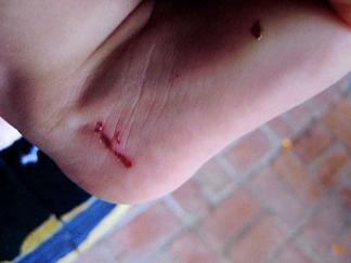 (WARNING: Disturbing Images) Baby Scratcher Admits Attacks