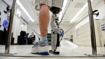 Navy Creates Advanced Prosthetics