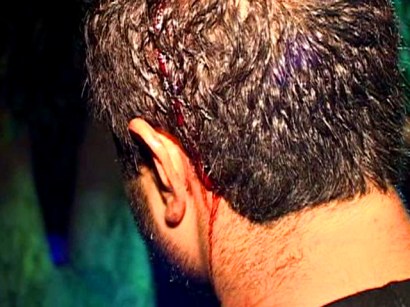 The victim of the Bar West fight The victim of the Bar West fight