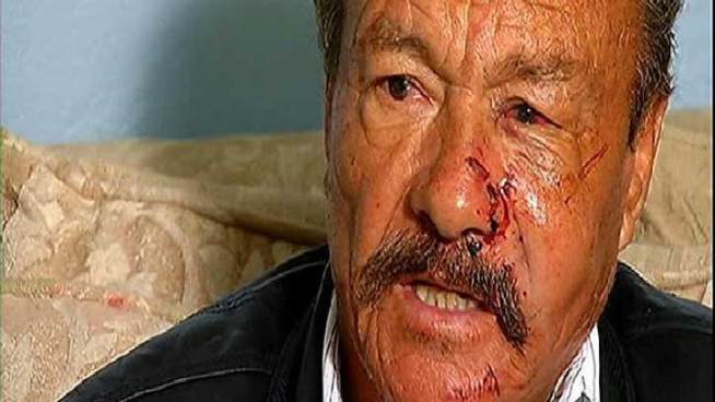 A City Heights father said he's lucky to be alive after being stabbed, punched and spray painted by four taggers. <a title=
