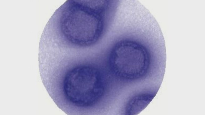 NBC 7's Chris Chan speaks to SDSU professor Joy Phillips about new research in preventing illness and death from the flu. The virus research is possible with the help of mice.