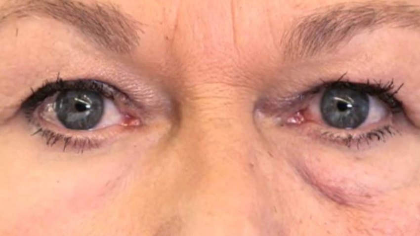 160509-second-skin-eyes-mdl_b07089e163e3774cad54b204caf36f04.nbcnews-ux-2880-1000