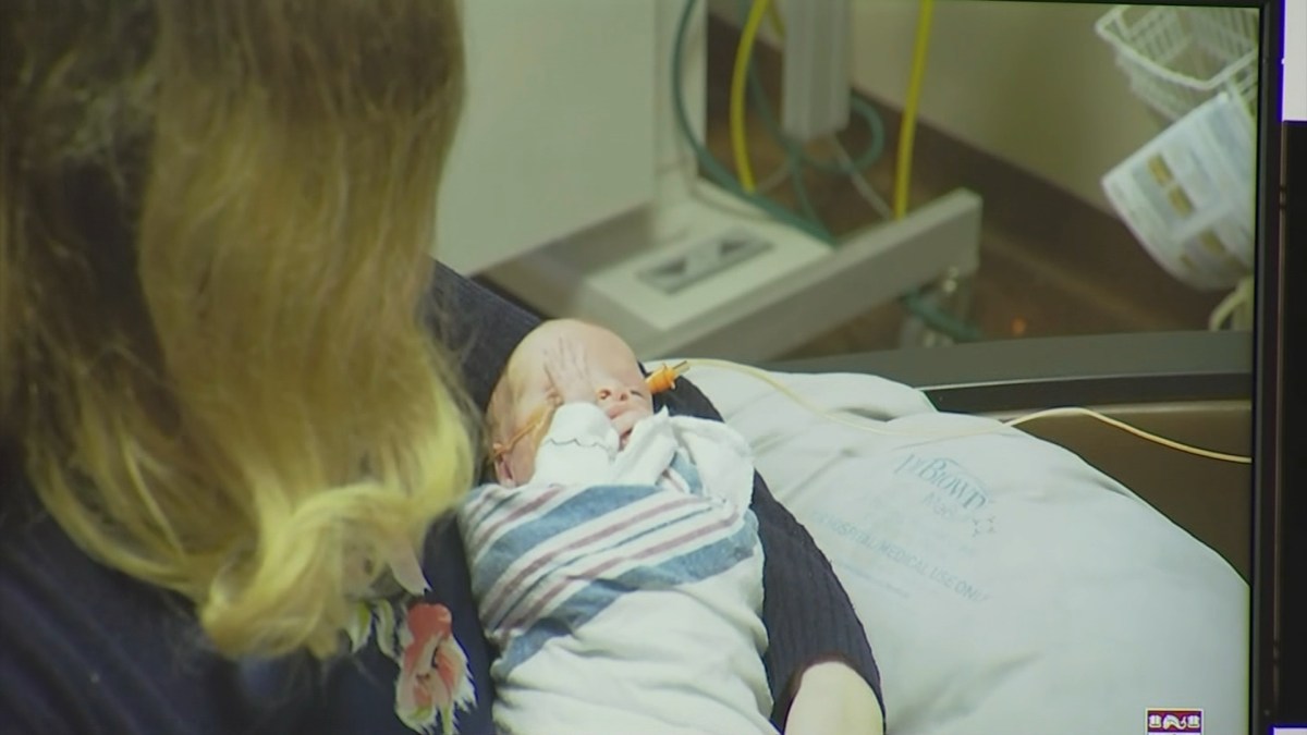 Woman Born Without Uterus Gives Birth After Groundbreaking Procedure NBC 7 San Diego
