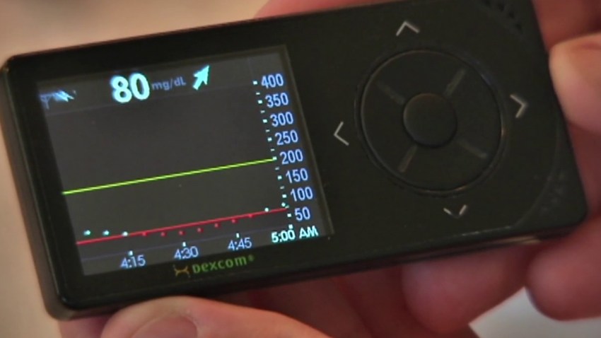 Dexcom-Blood-Sugar-041617