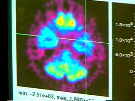 Early_Bird_Brain_45sec_706_large_448x336.jpg