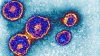 Mumps outbreak reported at SDSU, County says