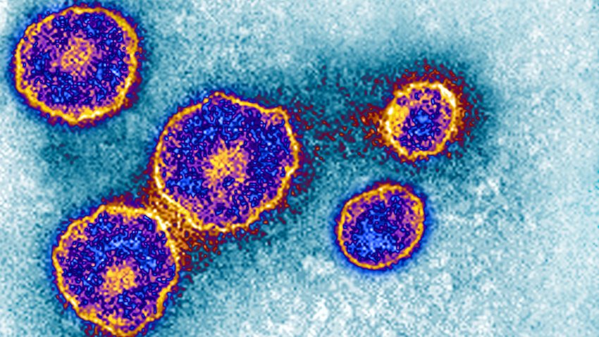 Mumps virus