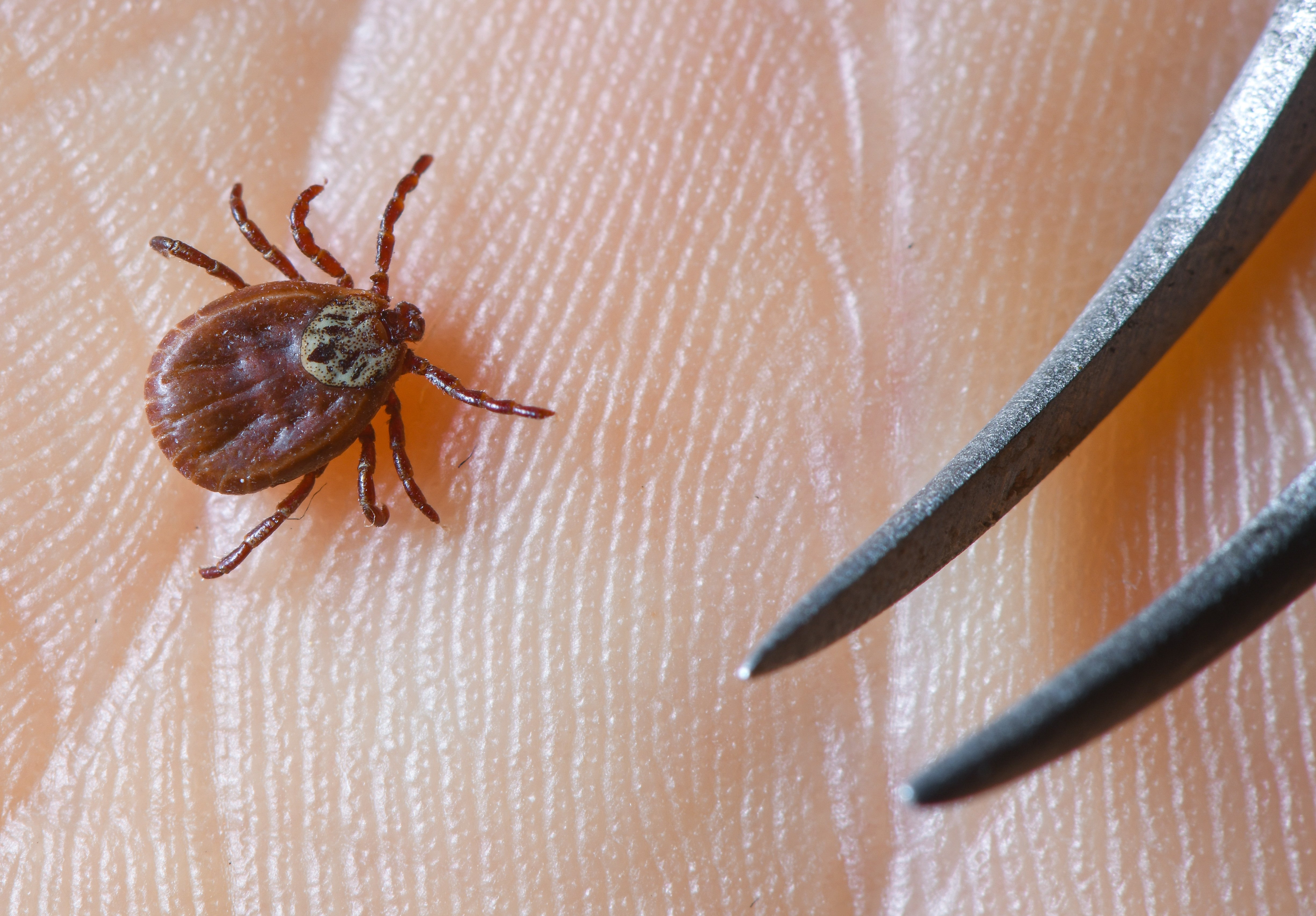 Tick-borne disease kills 17 people in Baja California - Vimarsana News