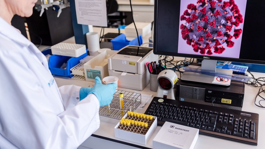 In this Feb. 28, 2020, file photo, a coronavirus patient sample detection test is seen in the virology research labs at UZ Leuven University Hospital in Leuven, Belgium.