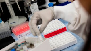 In this March 20, 2020, file photo, Dr. Nita Patel lifts a vial with a potential COVID-19 vaccine at Novavax labs in Rockville, Maryland.