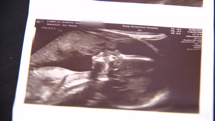 NOTTM VO ULTRASOUND FAT_KNSDA10Y