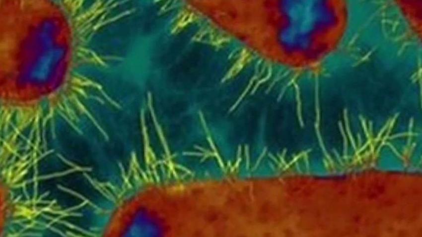 Parents_Concerned_After_E_Coli_Found_in_School_Water