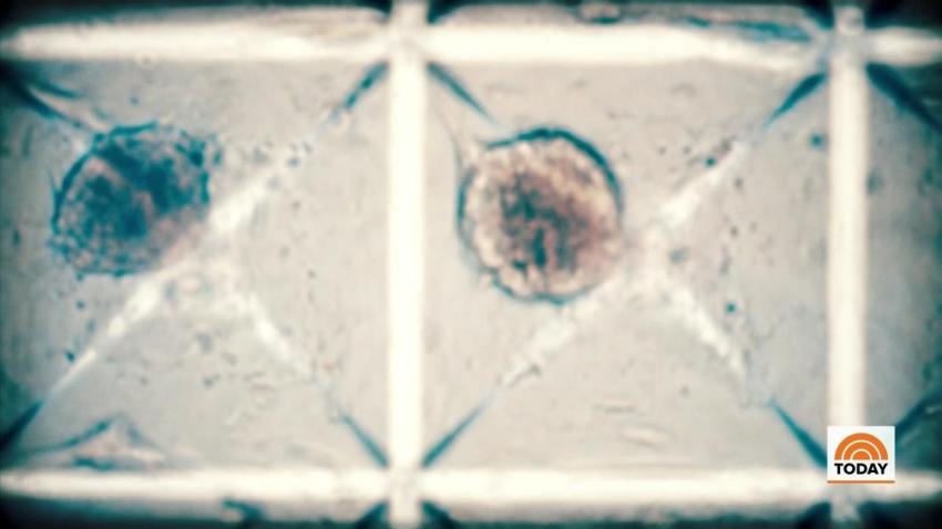 TODAY_STEM CELL SEGMENT_1.11.19