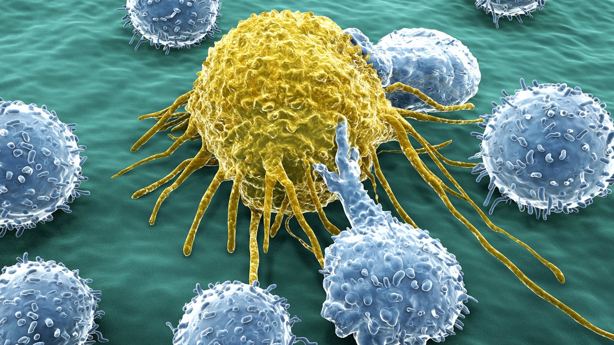 7 in 10 patients with cancer now survive 5+ years – NBC 7 San Diego