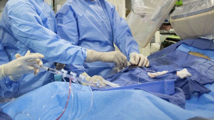 heart surgery1