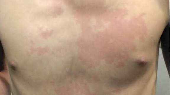 2 Marine Families Sue Over High Levels of Mold in Military Housing ...