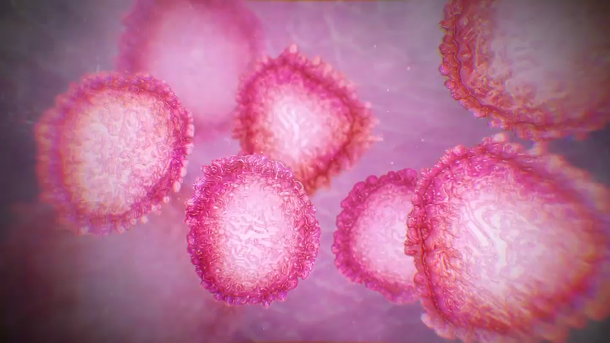 Possible Local Coronavirus Case Tested Negative: HHSA - NBC 7 San Diego