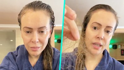 Alyssa Milano Reveals Shocking Hair Loss Months After Battling Covid 19 Nbc 7 San Diego