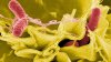 San Diego County investigates salmonella outbreak linked to Clairemont restaurant