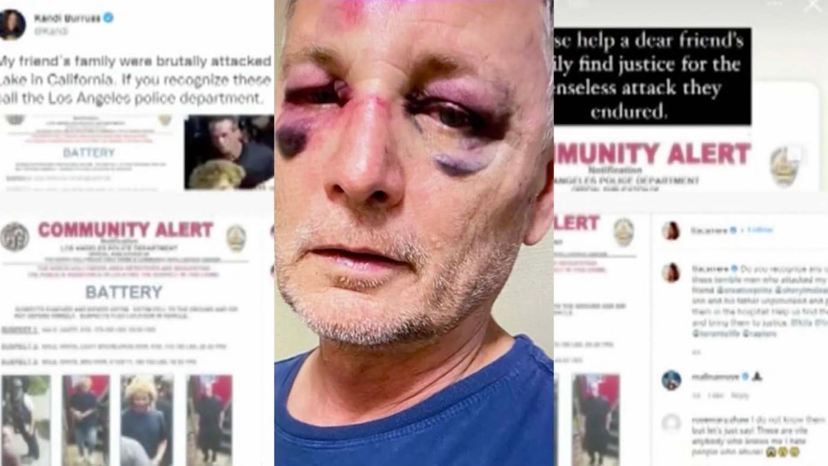 Chrissy Metz, Kandi Burruss Call for Action After Father and Son Attacked in Toluca Lake – NBC 7 San Diego - Vimarsana News