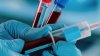 UCSD granted $11.3M to develop ‘smart' blood cells to improve military