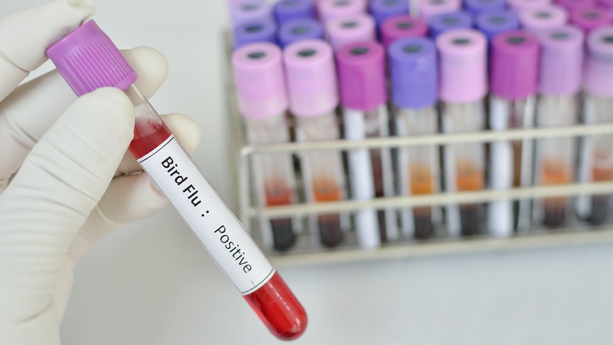 San Diego County Records First Bird Flu Case - Vimarsana News