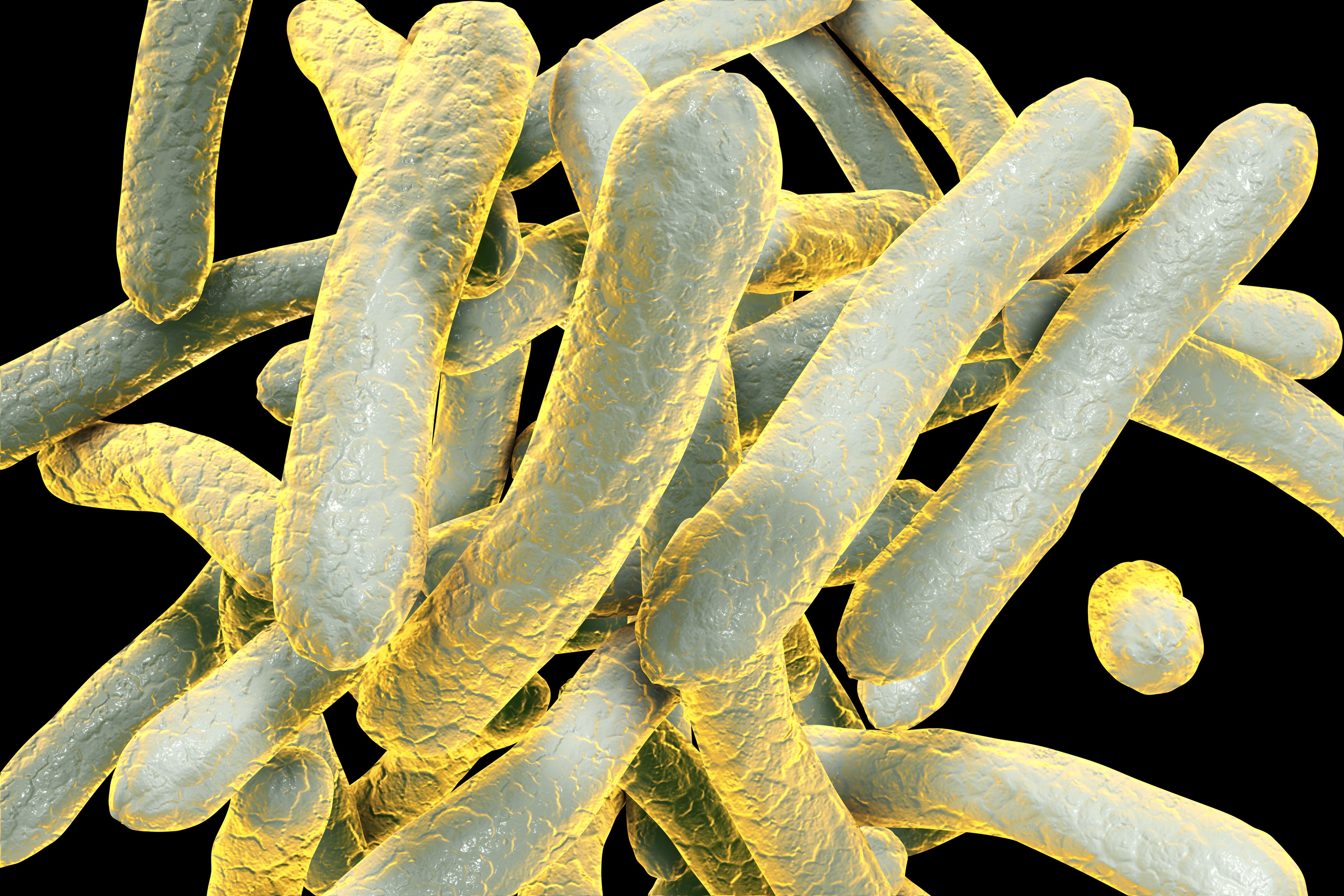 Potential tuberculosis exposure reported at Chula Vista's Innovation High School