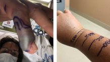 Murrieta woman bitten by rattlesnake. 