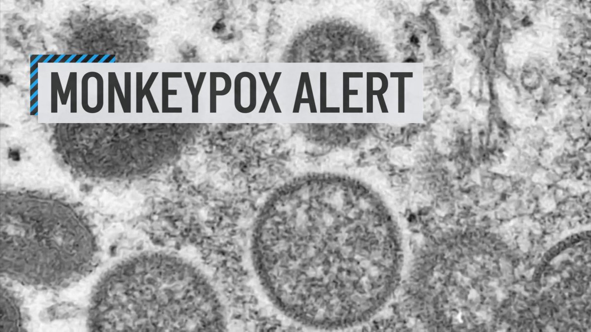 Governor Newsom Declares State of Emergency Over Monkeypox Outbreak