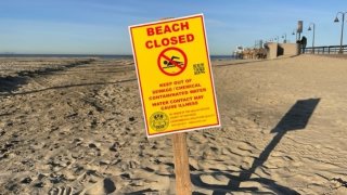 A sign at a beach in San Diego's South Bay warns visitors to keep out of the water due to contamination.