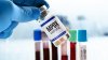 First Clade I mpox case diagnosed in San Diego County