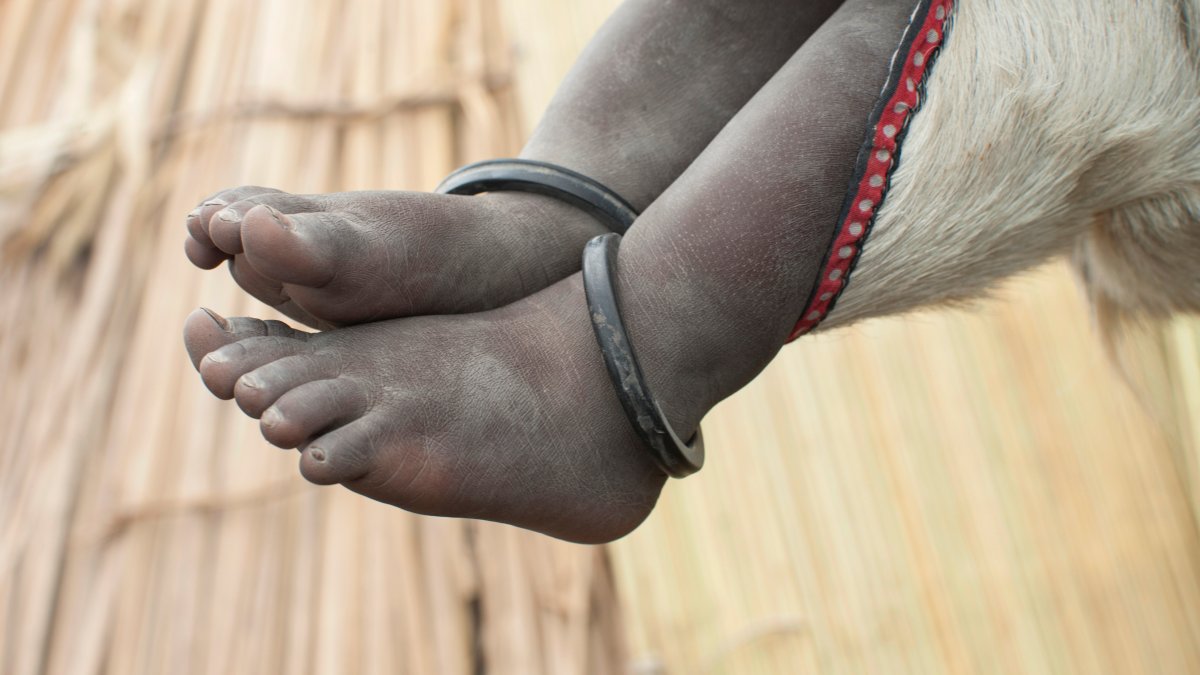 300 children rescued after 71 died in a Sudanese orphanage – NBC 7 San Diego - Vimarsana News