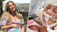 Influencer in Coma After Brain Aneurysm Ruptured at 9 Months Pregnant