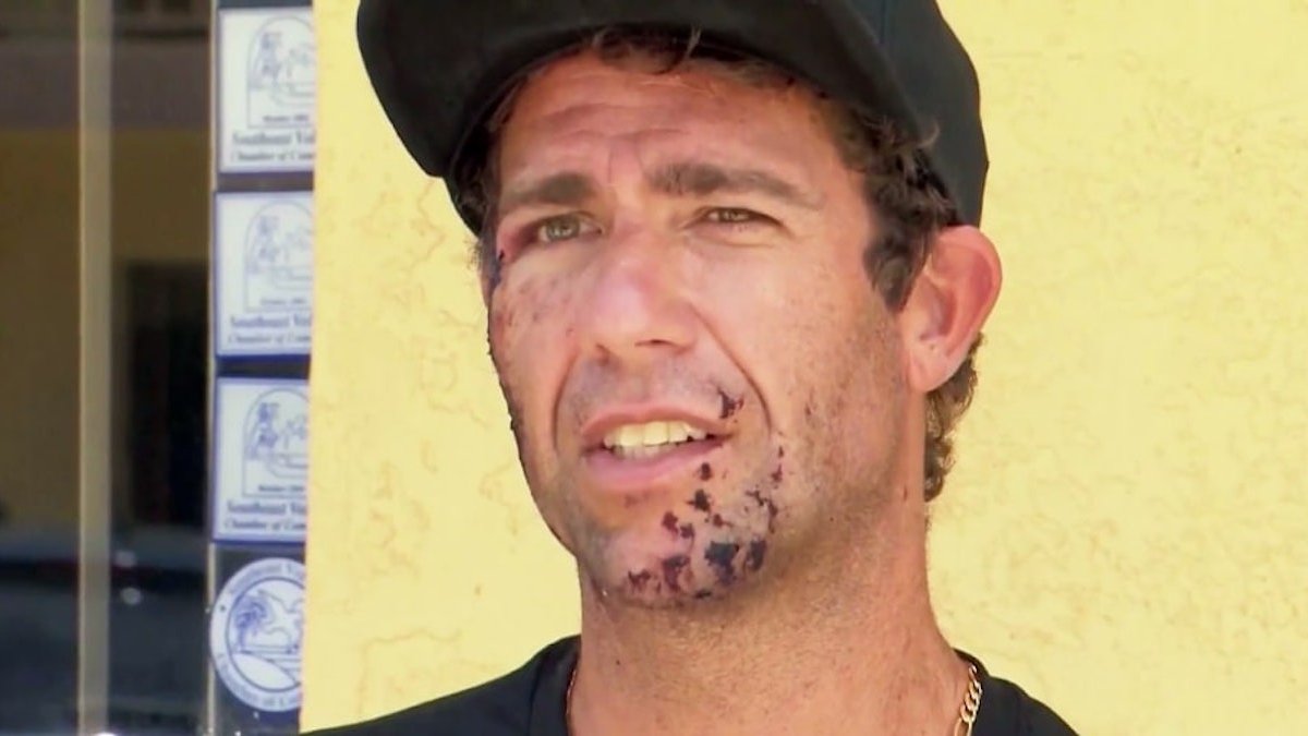 Surfer recalls getting bit in the face by shark at Florida beach – NBC 7 San Diego - Vimarsana News
