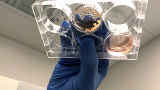 Organoids studied at the UC San Diego lab
