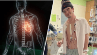 Doctors share warning signs after Virginia college athlete sidelined by heart condition